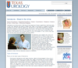 hematuria